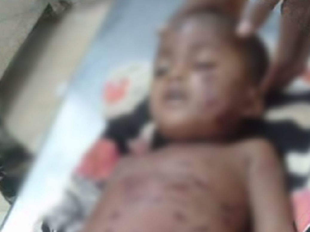 2 साल के मासूम पर लकड़बग्घा ने किया हमला इलाज के दौरान हुई मौत  मौत