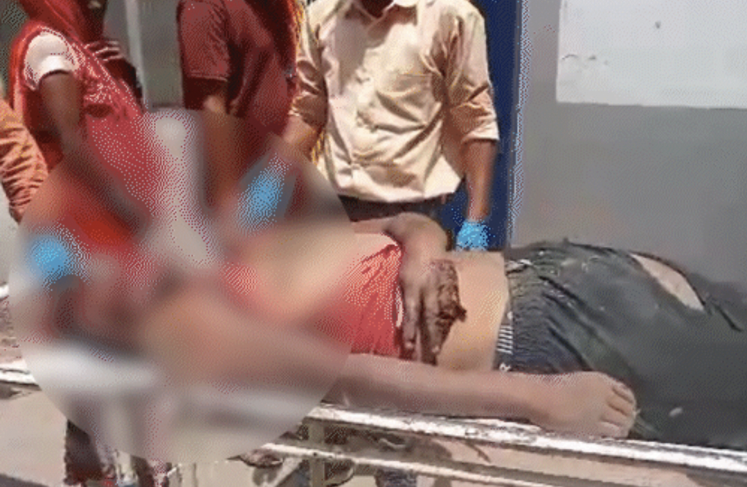 दो भाई सहित तीन की मौत: थाने से छूटकर जा रहे युवकों को वाहन ने मारी टक्कर, तीनों की गई जान...