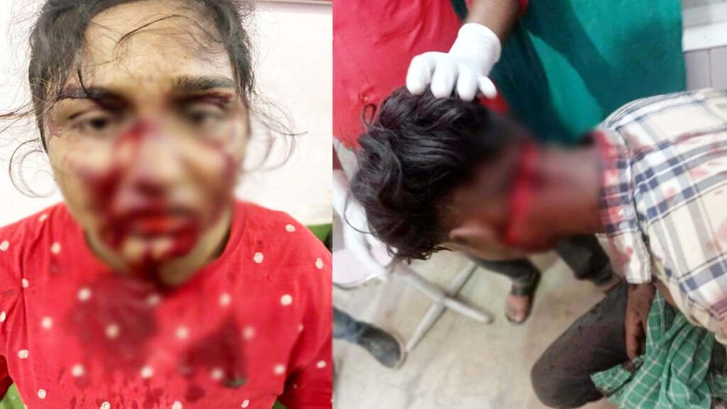 न्यायधानी में भाई-बहन पर हुआ चाकू से जानलेवा हमला