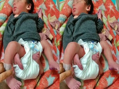 जिले में पैदा हुआ अनोखा बच्चा, बच्चे के है 4 हाथ और 4 पैर, डॉक्टर भी हैरान&hellip;