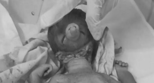 OMG ! &lsquo;भगवान गणेश&rsquo; जैसी शक्ल वाले बच्चे ने लिया जन्म! लेकिन फिर&hellip;